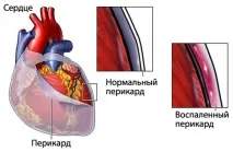 болка