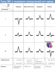 Шестиосьова система координат ЕКГ система