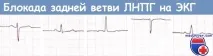 Шестиосьова система координат ЕКГ система