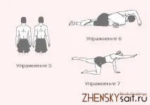сколіозі