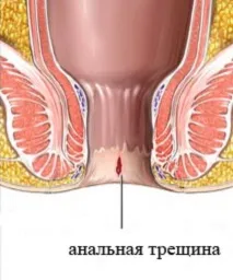 причините