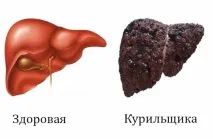 Куріння та печінка вплив нікотину та шкода (фото) куріння