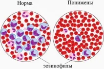 Еозинофіли у крові у чоловіків - норма за віком, таблиця норма