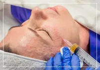 Дрібна сіточка зморшок вікові зміни, які не можна ігнорувати дрібна