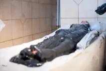 Методи лікування псоріазу глиною та грязями як впливають на недугу сакськілікувальні грязі та блакитна глиною