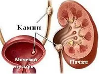 інструкція