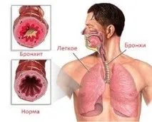 склад