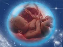 Рахісхізіс - дефект внутрішньоутробного розвитку дефект