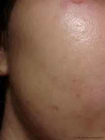 Сироватка для обличчя Even Better Clinical Dark Spot Corrector від Clinique – відгуки покупців clinical