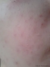 Сироватка для обличчя Even Better Clinical Dark Spot Corrector від Clinique – відгуки покупців clinical