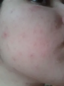 Сироватка для обличчя Even Better Clinical Dark Spot Corrector від Clinique – відгуки покупців clinical