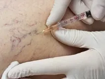ціни