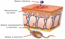 лікування