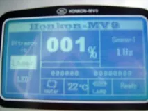 HONKON YILIYA-MV9 Nd YAG Laser з модулятором дробності laser