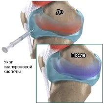 инструкции