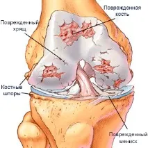 реабілітація