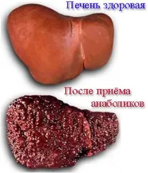 Вплив стероїдів на печінку печінку