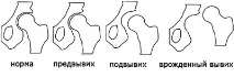 розвитку