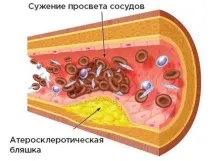 съдовете