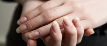 Як швидко відбілити нігті в домашніх умовах домашніх