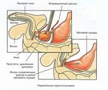 Як раціонально використовувати молоко простати для діагностики раціонально
