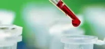 Які слід здати аналізи на уреаплазму spp слід
