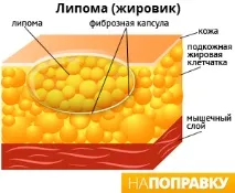 лікування