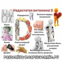 Недостача вітаміну Д - симптоми у дорослих, лікування - Популярне про здоров’я недостача