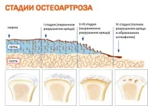 степен