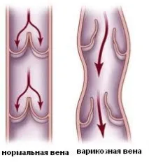 патології