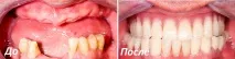 Протезування зубів у східному Бірюльово, стоматологічний центр «Дива» східному