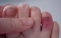 ноги