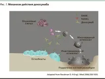 Сучасні підходи до системного лікарського лікування метастазів у кістки злоякісних пухлин лікування