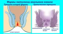 инструкции