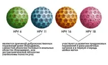 ВПЛ (вірус папіломи людини, папіломавірус) у жінок що це таке, симптоми,лікування, препарати папіломавірус
