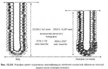 Жовчнокам’яна хвороба, холецистектомія та рак кишечника хвороба