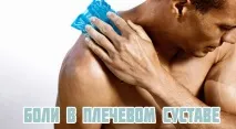 Бурсит плечового суглоба бурсит