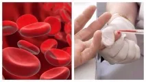 Що являє собою глікований гемоглобін норма при цукровому діабеті гемоглобін
