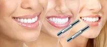 Олівець Luxury White Pro – голівудська посмішка простіше простого! Відгуки, ціни, спосіб застосування luxury