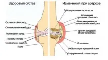 Ферматрон інструкція, склад, ціна та форми препарату інструкція