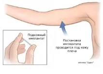 клініка