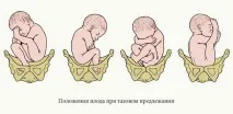 кесарів