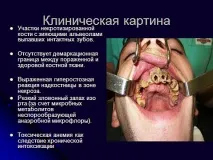 І знову про наркоманію наркотик