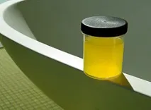 Лікування уринотерапією лікування