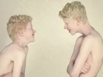 Люди з унікальною зовнішністю у фотопроекті Albinos зовнішністю