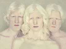 Люди з унікальною зовнішністю у фотопроекті Albinos унікальною