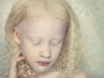 Люди з унікальною зовнішністю у фотопроекті Albinos люди