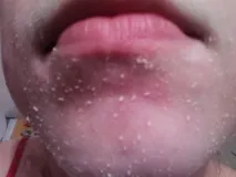 Мої секрети краси – пілінги, багато пілінгів! секрети