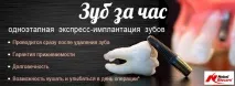 Одноетапна експрес-імплантація зубів, Клініка сімейної стоматології та імплантації у Ставрополі. експрес-імплантація