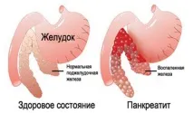 Панкреатит - Причини виникнення панкреатиту у тварин - Як лікувати панкреатит у тварин причини